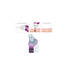 Beurer - FC 41 Power Deep Pore Cleanser - 3  Years Warranty / Beauty Accessories Woman Care