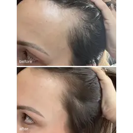 UKLASH - Ukhair Hair Growth Serum 30ml / Beauty Φροντιδα Μαλλιών Περιποίηση Μαλλιών