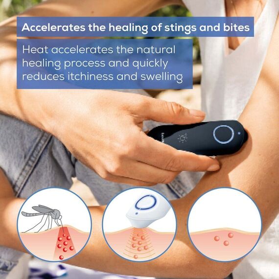 Beurer - BR 90 Insect Bite Healer - 5 Years Warranty / Health and Personal Care Wellness Personal Care