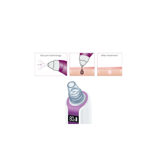 Beurer - FC 41 Power Deep Pore Cleanser - 3  Years Warranty / Beauty Accessories Woman Care