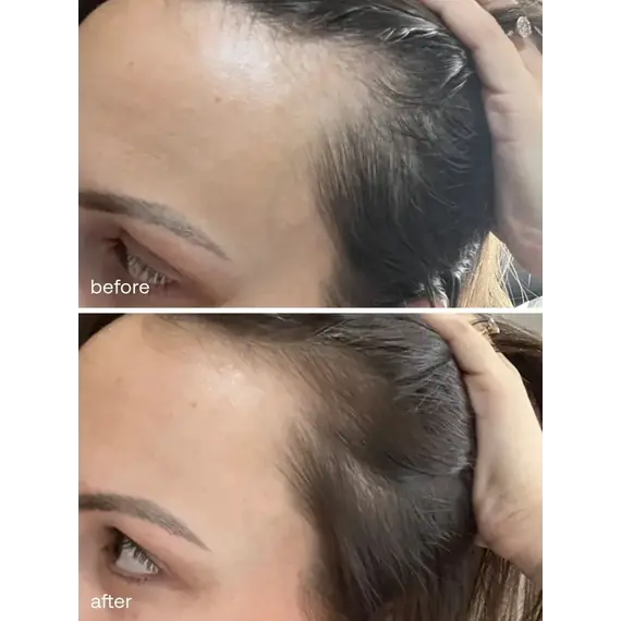 UKLASH - Ukhair Hair Growth Serum 30ml / Beauty Φροντιδα Μαλλιών Περιποίηση Μαλλιών