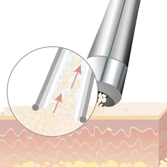 Beurer - FC 100 Pureo Derma Peel Microdermabrasion - 3 Years Warranty / Beauty Uncategorized (Beauty)