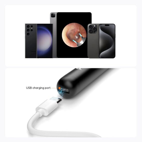 Bebird EarSight R1 Otoscope with camera 180 mAh White