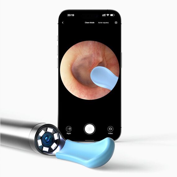 Bebird EarSight R1 Otoscope with camera 180 mAh White