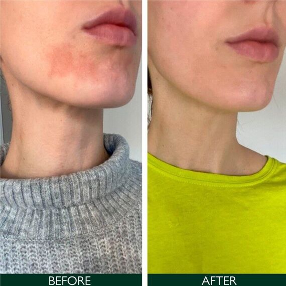 Sorted Skin - Intensive Rescue Face Lotion 50 ml / Beauty Πρόσωπο Περιποίηση Προσώπου