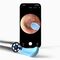 Bebird EarSight R1 Otoscope with camera 180 mAh White